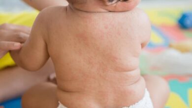 Trẻ bị sốt phát ban tắm lá gì? 8 loại lá an toàn với làn da của bé
