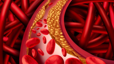 Mỡ máu bao nhiêu là cao và các thông tin liên quan khác | Medlatec