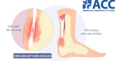 Viêm gân gót chân Achilles có nguy hiểm không? Bao lâu thì khỏi? | ACC