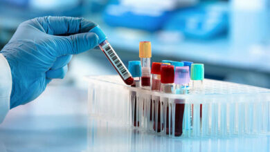 Eos thấp trong xét nghiệm máu là gì