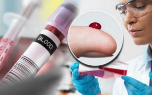 Kết quả xét nghiệm máu mpv là gì