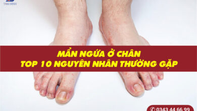 Nổi mẩn đỏ ở chân là bệnh gì