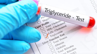 Xét nghiệm chỉ số Triglyceride chẩn đoán bệnh gì cho bạn? | Medlatec
